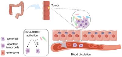 Research progress on the impact of intratumoral microbiota on the immune microenvironment of malignant tumors and its role in immunotherapy